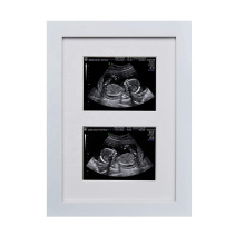 Creative custom 7x10 white wood Pregnancy Scan 1st Photo Hand Made Double Aperture picture Frame for Baby Shower Gift